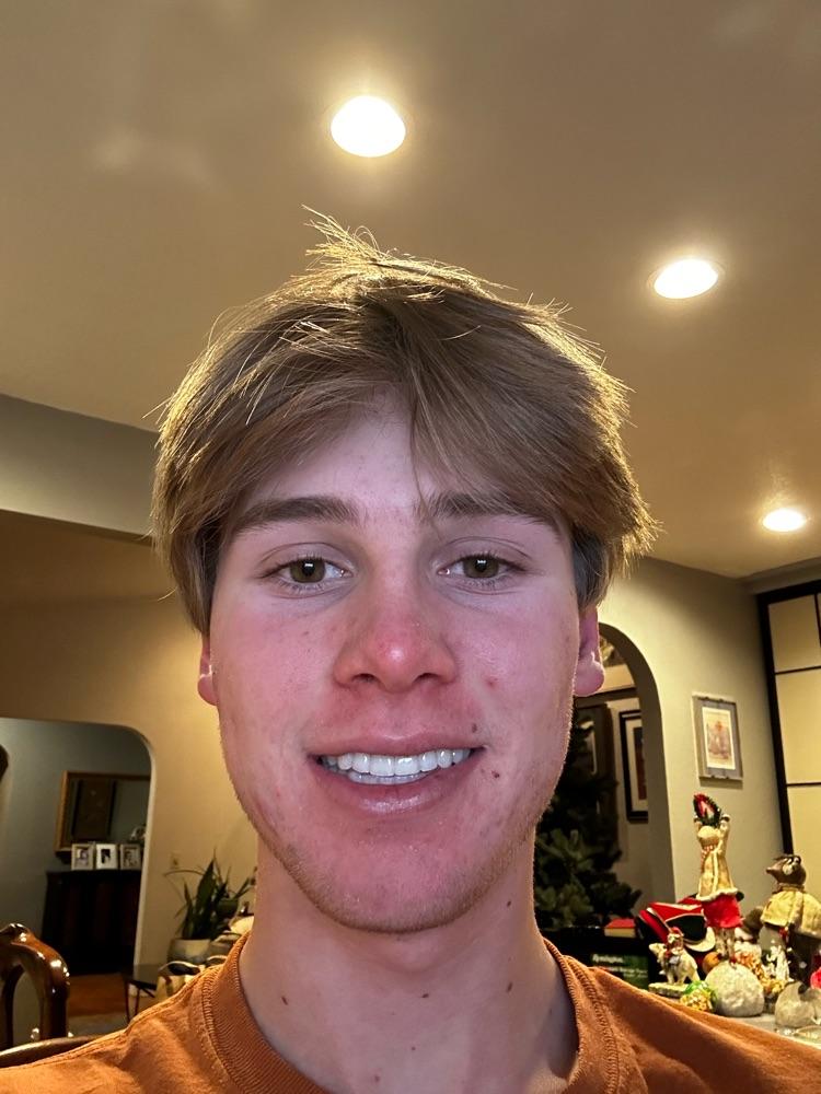 Caelm04